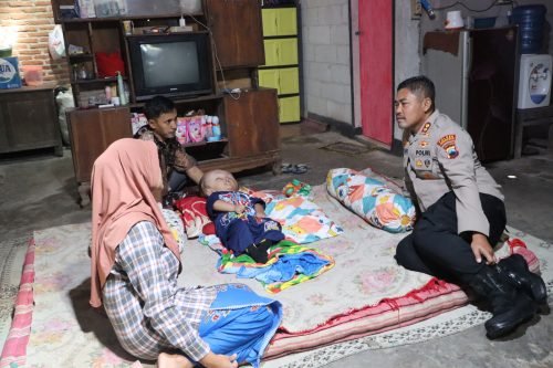 Polda Jateng Ringankan Beban Balita Hidrosefalus di Grobogan
